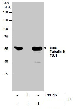 beta-3 Tubulin Antibody in Immunoprecipitation (IP)