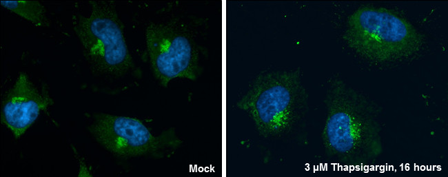 GM130 Antibody in Immunocytochemistry (ICC/IF)