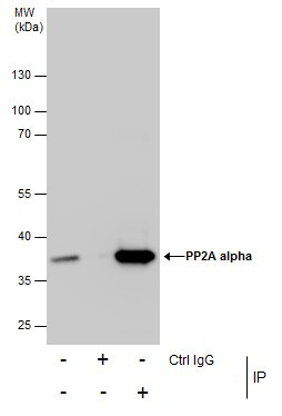 PP2A alpha Antibody in Immunoprecipitation (IP)