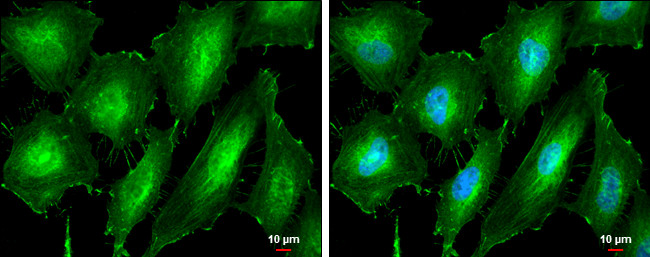 PKC alpha Antibody in Immunocytochemistry (ICC/IF)