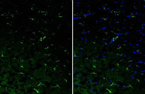 IL-10 Antibody in Immunohistochemistry (Frozen) (IHC (F))