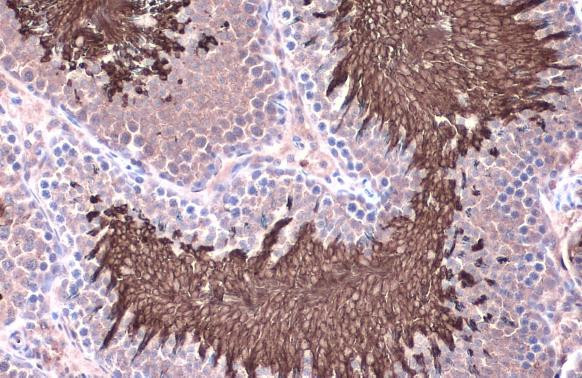 ACE Antibody in Immunohistochemistry (Paraffin) (IHC (P))