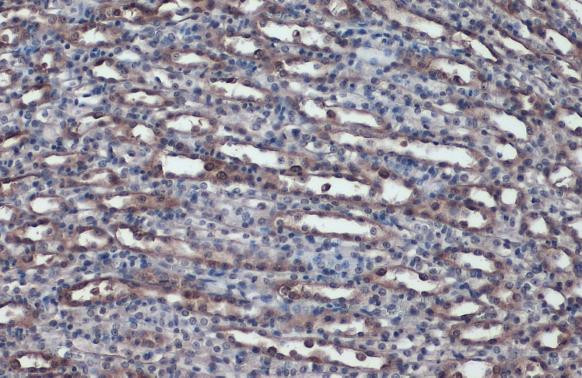 ACE Antibody in Immunohistochemistry (Paraffin) (IHC (P))