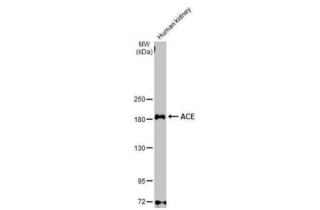 ACE Antibody in Western Blot (WB)