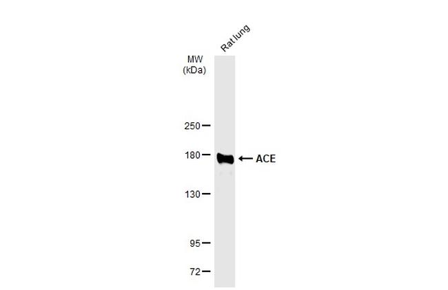 ACE Antibody in Western Blot (WB)