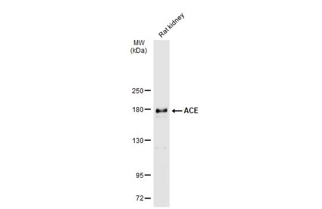 ACE Antibody in Western Blot (WB)