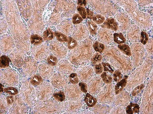 Calbindin D28K Antibody in Immunohistochemistry (Paraffin) (IHC (P))