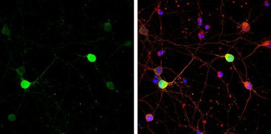 Calbindin D28K Antibody in Immunocytochemistry (ICC/IF)