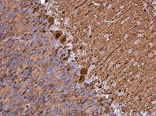 Calbindin D28K Antibody in Immunohistochemistry (Paraffin) (IHC (P))