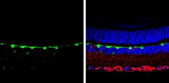 Calbindin D28K Antibody in Immunohistochemistry (Paraffin) (IHC (P))