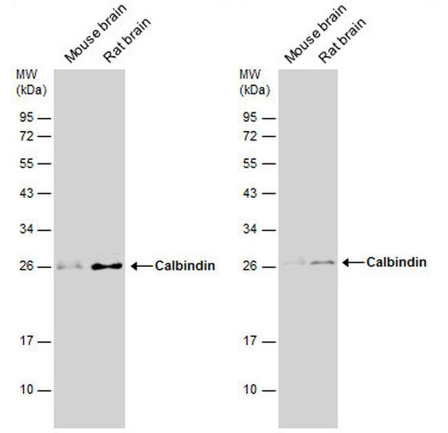 Calbindin D28K Antibody in Western Blot (WB)