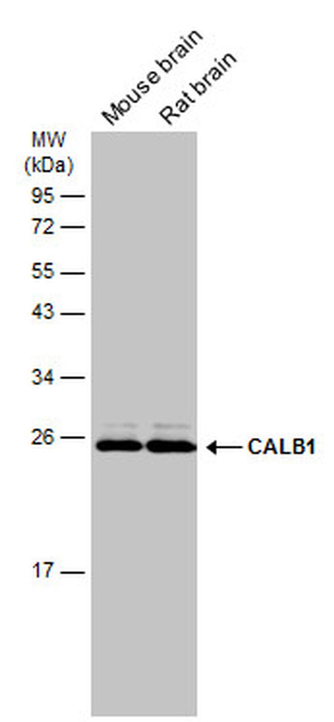 Calbindin D28K Antibody in Western Blot (WB)