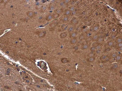 GAMT Antibody in Immunohistochemistry (Paraffin) (IHC (P))