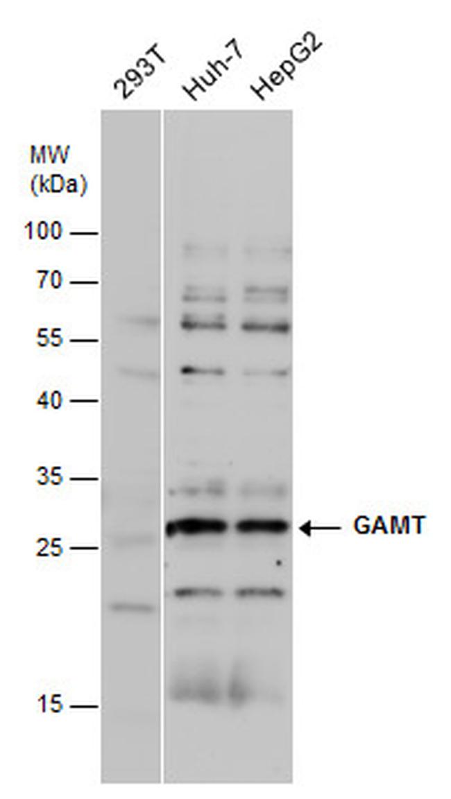 GAMT Antibody in Western Blot (WB)