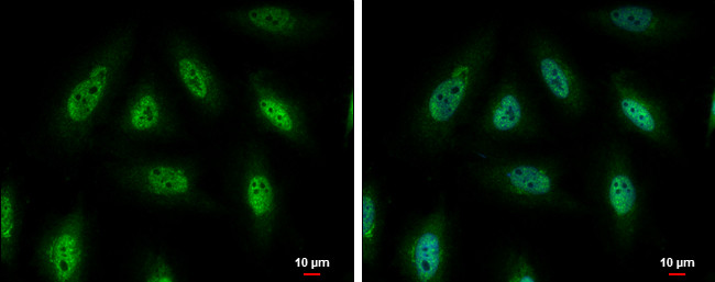 PYK2 Antibody in Immunocytochemistry (ICC/IF)