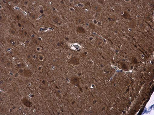 PYK2 Antibody in Immunohistochemistry (Paraffin) (IHC (P))