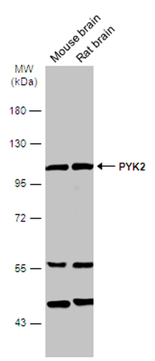 PYK2 Antibody in Western Blot (WB)