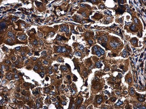 PKR Antibody in Immunohistochemistry (Paraffin) (IHC (P))