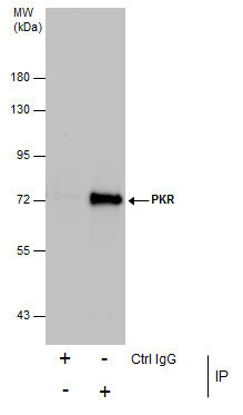 PKR Antibody in Immunoprecipitation (IP)