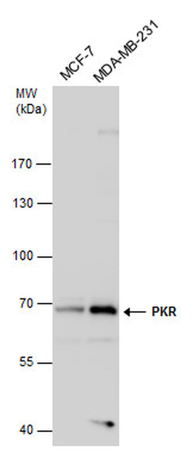 PKR Antibody in Western Blot (WB)