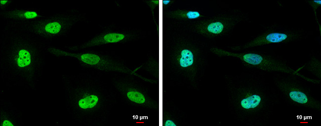 DHX9 Antibody in Immunocytochemistry (ICC/IF)