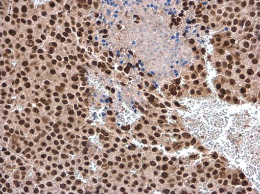 DHX9 Antibody in Immunohistochemistry (Paraffin) (IHC (P))