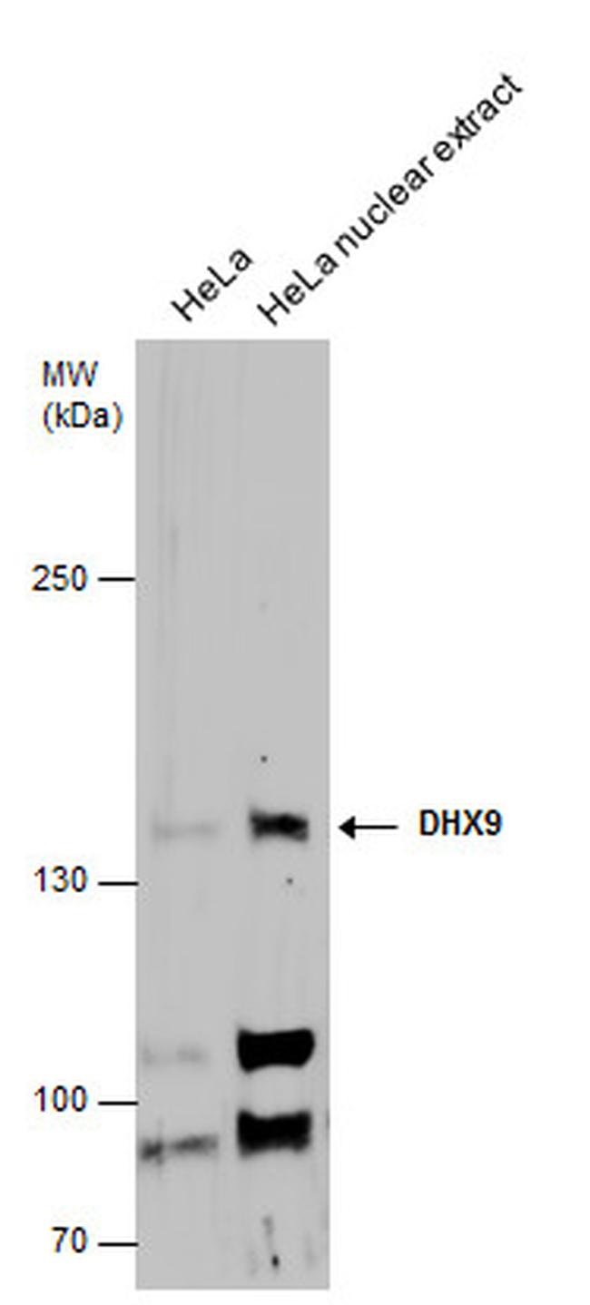 DHX9 Antibody in Western Blot (WB)