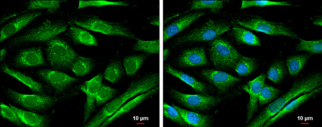 ATL1 Antibody in Immunocytochemistry (ICC/IF)