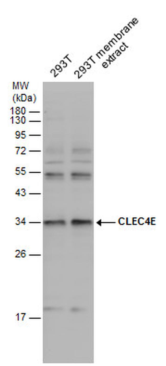 CLEC4E Antibody in Western Blot (WB)