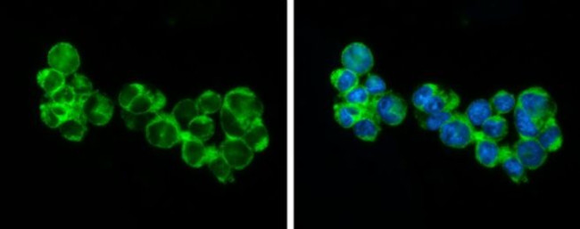 RIP3 Antibody in Immunocytochemistry (ICC/IF)