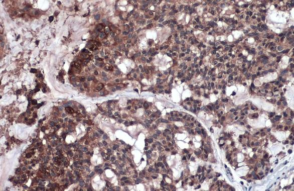 RIP3 Antibody in Immunohistochemistry (Paraffin) (IHC (P))