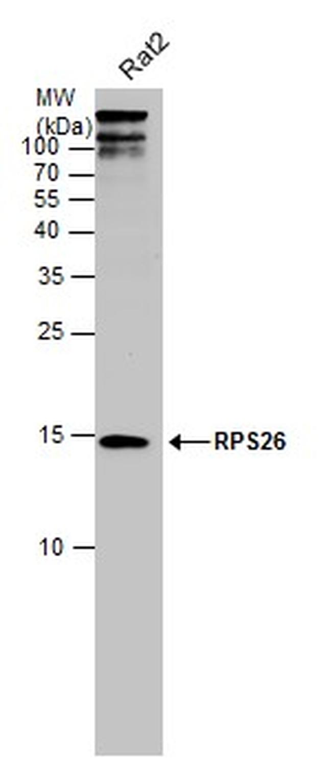 RPS26 Antibody in Western Blot (WB)