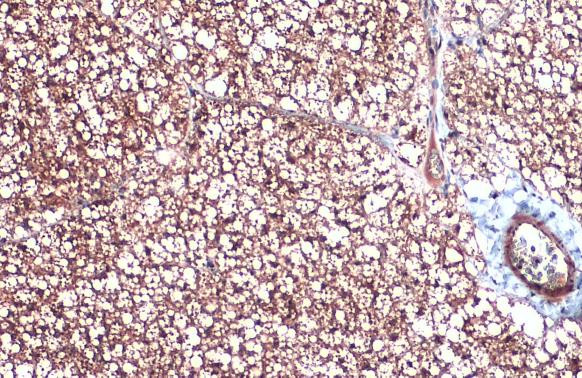 UCP1 Antibody in Immunohistochemistry (Paraffin) (IHC (P))