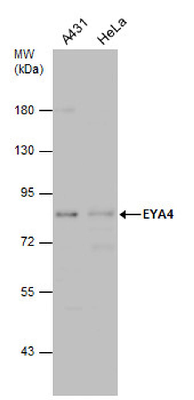 EYA4 Antibody in Western Blot (WB)