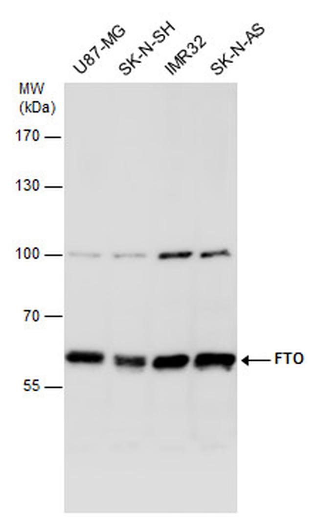 FTO Antibody in Western Blot (WB)