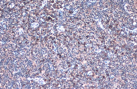 IL-32 Antibody in Immunohistochemistry (Paraffin) (IHC (P))