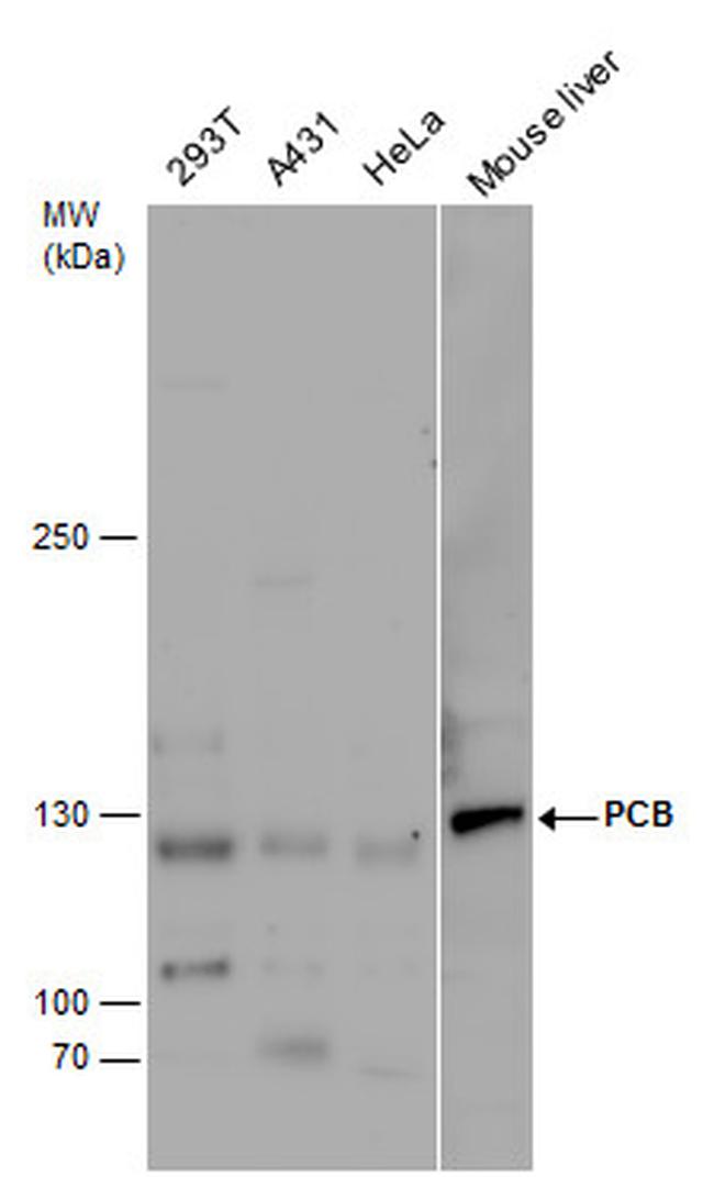 Pyruvate Carboxylase Antibody in Western Blot (WB)