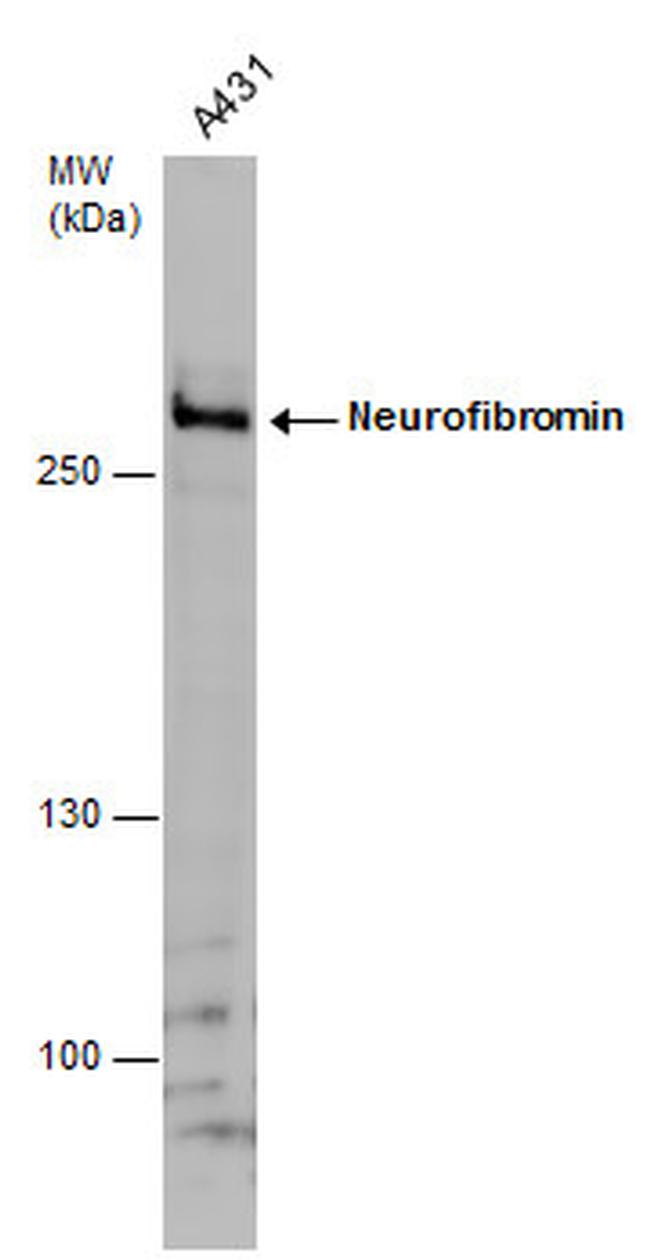 NF1 Antibody in Western Blot (WB)