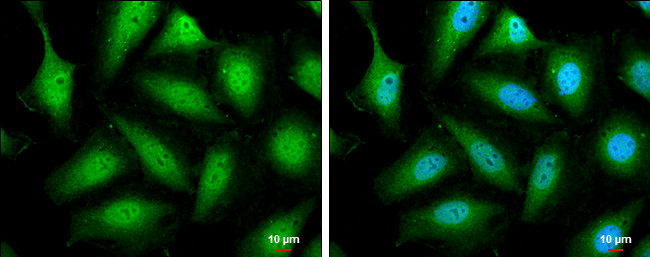 STAT5 beta Antibody in Immunocytochemistry (ICC/IF)