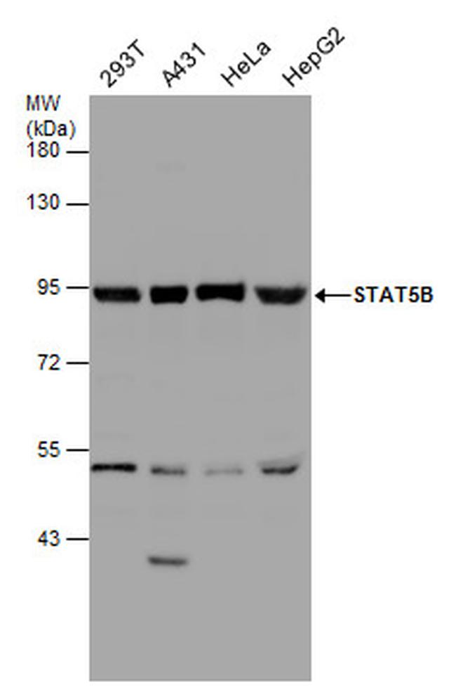 STAT5 beta Antibody in Western Blot (WB)