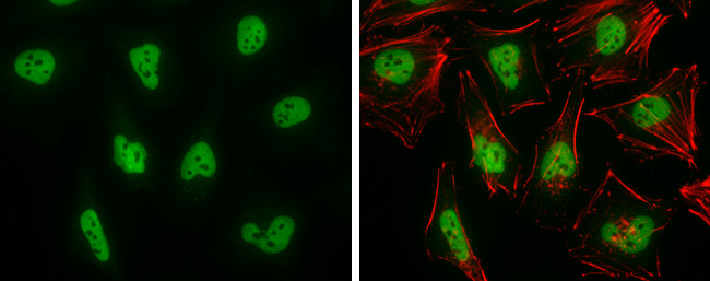 BRG1 Antibody in Immunocytochemistry (ICC/IF)