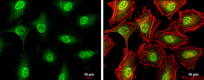 ATM Antibody in Immunocytochemistry (ICC/IF)