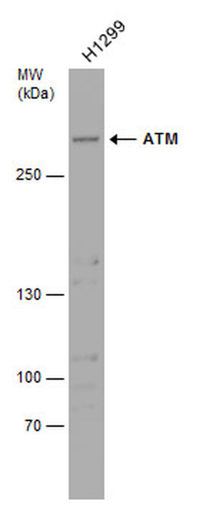 ATM Antibody in Western Blot (WB)