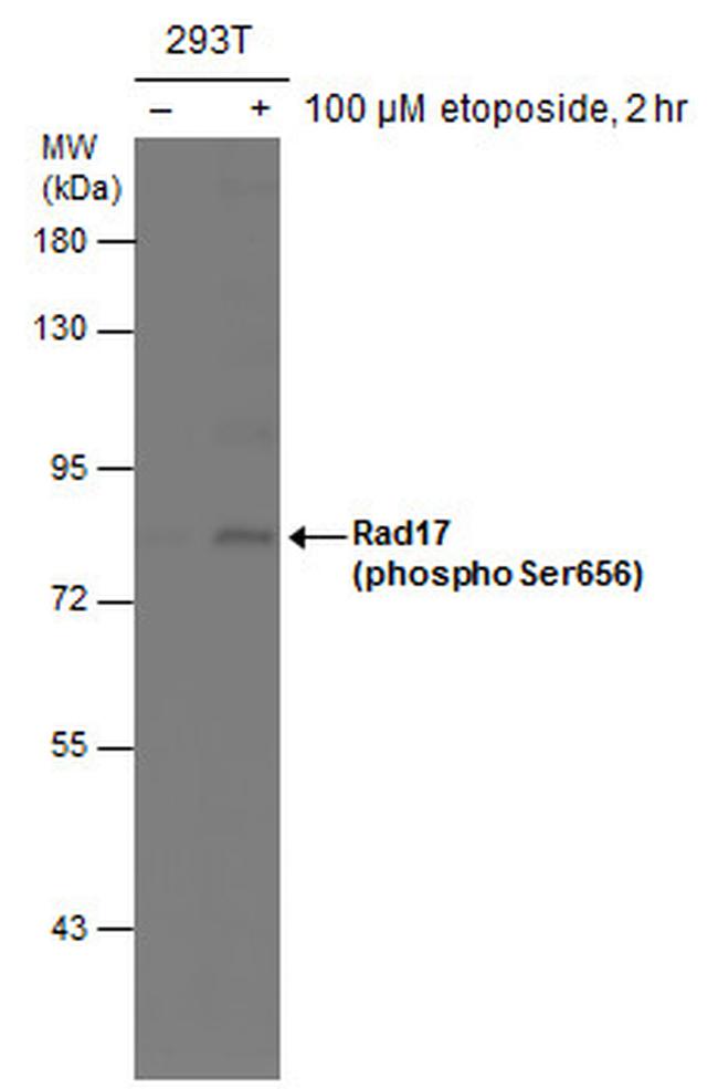 Phospho-RAD17 (Ser656) Antibody in Western Blot (WB)