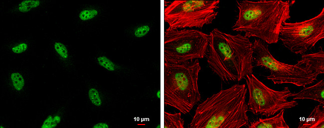 Phospho-RAD17 (Ser656) Antibody in Immunocytochemistry (ICC/IF)