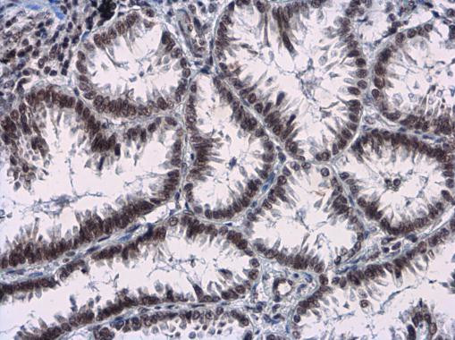 Phospho-RAD17 (Ser656) Antibody in Immunohistochemistry (Paraffin) (IHC (P))