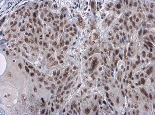 Phospho-RAD17 (Ser656) Antibody in Immunohistochemistry (Paraffin) (IHC (P))