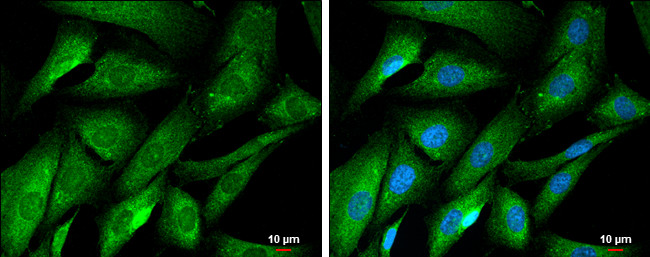 Huntingtin Antibody in Immunocytochemistry (ICC/IF)