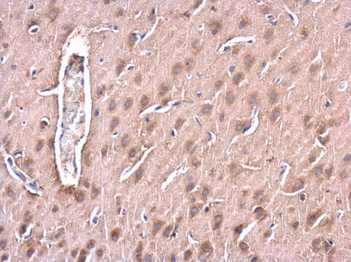 Huntingtin Antibody in Immunohistochemistry (Paraffin) (IHC (P))