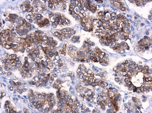 ATG10 Antibody in Immunohistochemistry (Paraffin) (IHC (P))